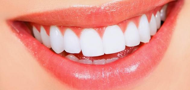 أنواع تلبيسات الأسنان