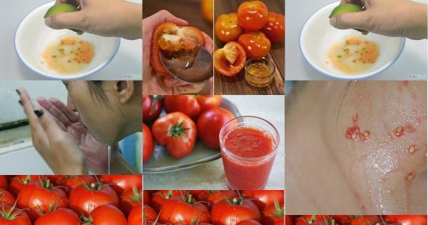 ما هي فوائد الطماطم للبشرة ؟